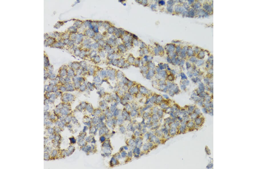 Immunohistochemistry - Anti-PI3 Antibody (A12482) - Antibodies.com