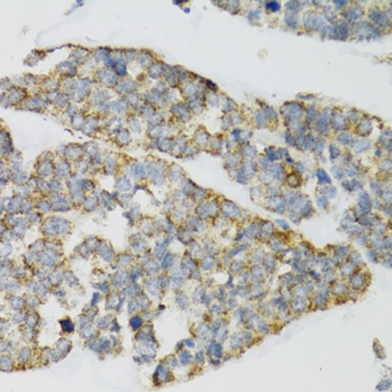 Immunohistochemistry - Anti-PI3 Antibody (A12482) - Antibodies.com