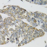 Immunohistochemistry - Anti-PI3 Antibody (A12482) - Antibodies.com