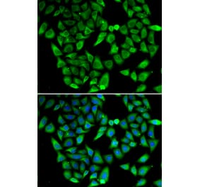 Immunofluorescence - Anti-ASIP Antibody (A92274) - Antibodies.com