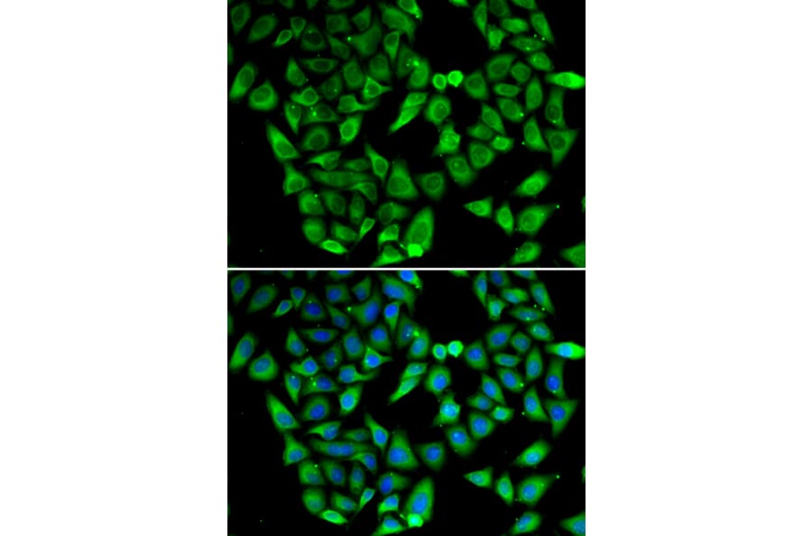 Immunofluorescence - Anti-ASIP Antibody (A92274) - Antibodies.com