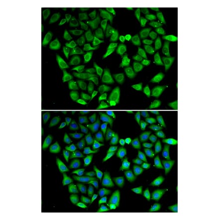 Immunofluorescence - Anti-ASIP Antibody (A92274) - Antibodies.com