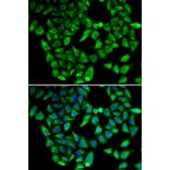 Immunofluorescence - Anti-ASIP Antibody (A92274) - Antibodies.com