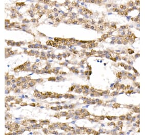 Immunohistochemistry - Anti-CYP11B1 Antibody (A92278) - Antibodies.com