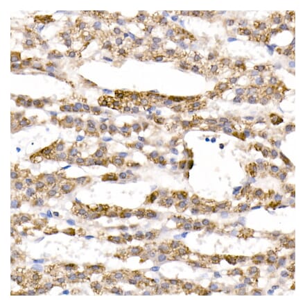 Immunohistochemistry - Anti-CYP11B1 Antibody (A92278) - Antibodies.com