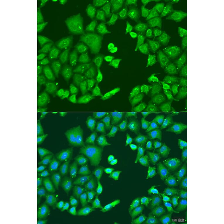 Immunofluorescence - Anti-CYP11B1 Antibody (A92278) - Antibodies.com