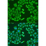 Immunofluorescence - Anti-CYP11B1 Antibody (A92278) - Antibodies.com