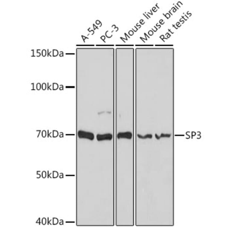 Western Blot - Anti-SP3 Antibody (A92279) - Antibodies.com