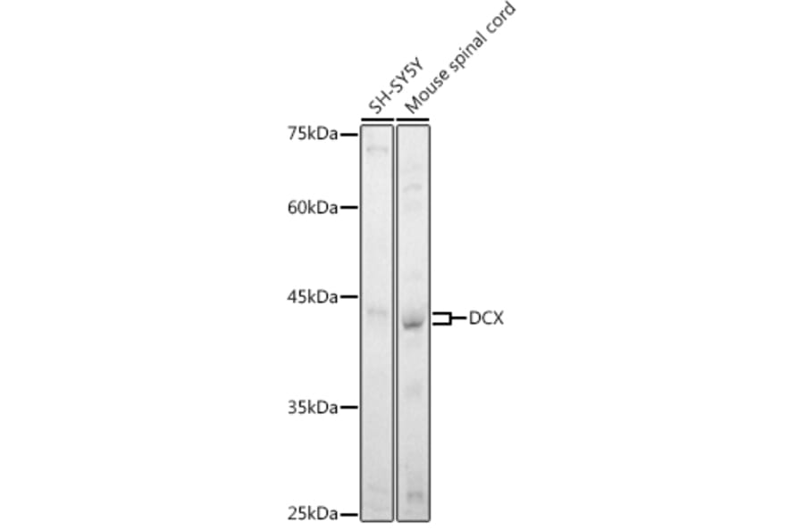 Western Blot - Anti-Doublecortin Antibody (A92280) - Antibodies.com