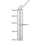 Western Blot - Anti-Doublecortin Antibody (A92280) - Antibodies.com