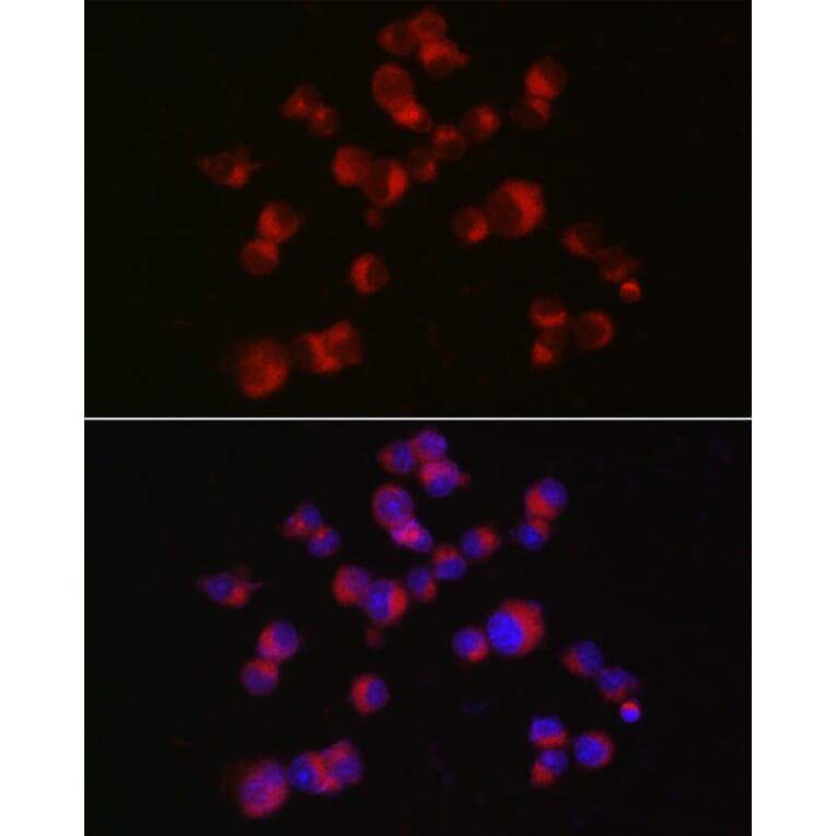 Immunofluorescence - Anti-Doublecortin Antibody (A92280) - Antibodies.com