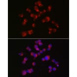 Immunofluorescence - Anti-Doublecortin Antibody (A92280) - Antibodies.com