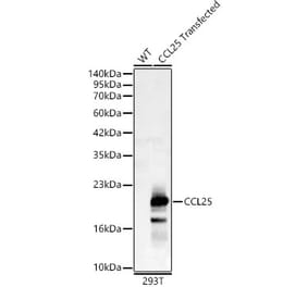Western Blot - Anti-CCL25 Antibody (A92282) - Antibodies.com