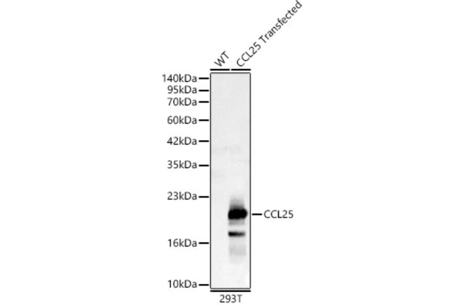Western Blot - Anti-CCL25 Antibody (A92282) - Antibodies.com