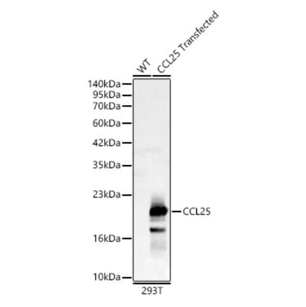 Western Blot - Anti-CCL25 Antibody (A92282) - Antibodies.com