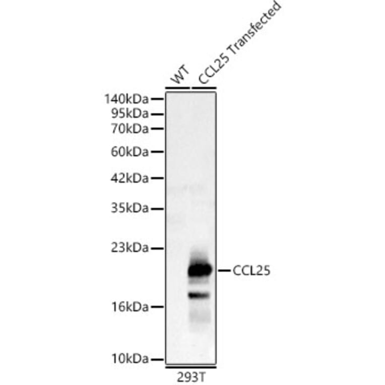 Western Blot - Anti-CCL25 Antibody (A92282) - Antibodies.com