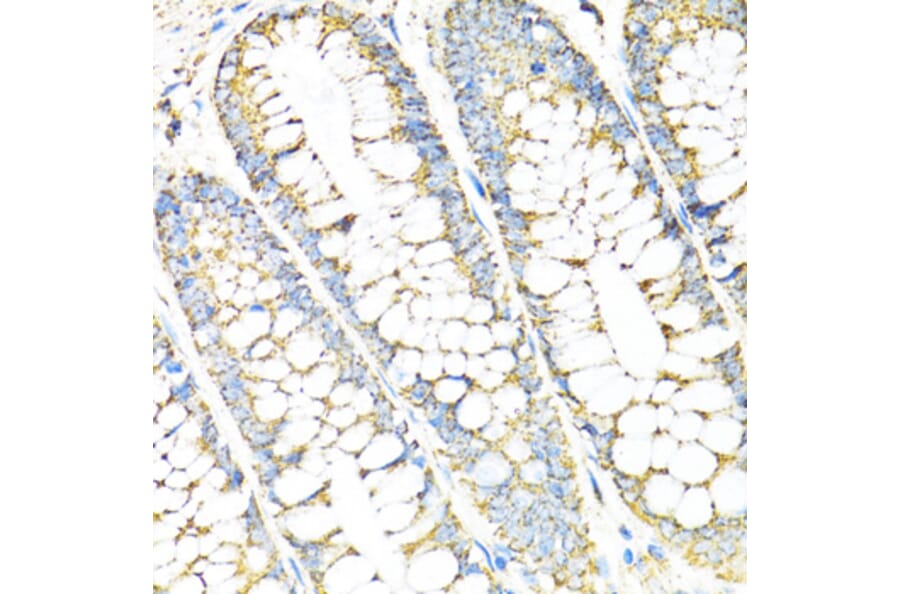 Immunohistochemistry - Anti-SERPINE1 Antibody (A14758) - Antibodies.com