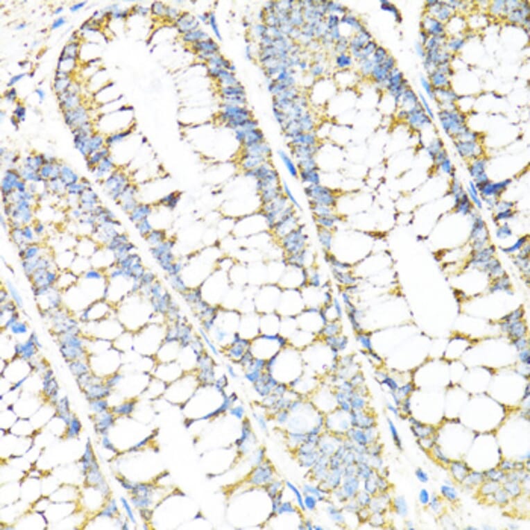 Immunohistochemistry - Anti-SERPINE1 Antibody (A14758) - Antibodies.com