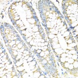 Immunohistochemistry - Anti-SERPINE1 Antibody (A14758) - Antibodies.com