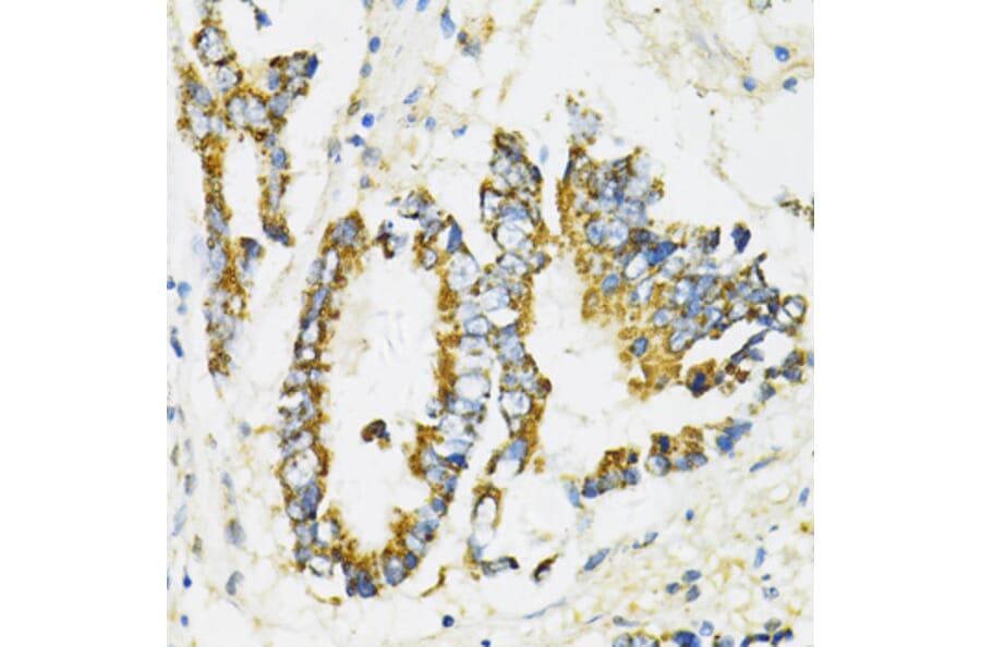 Immunohistochemistry - Anti-SERPINE1 Antibody (A14758) - Antibodies.com