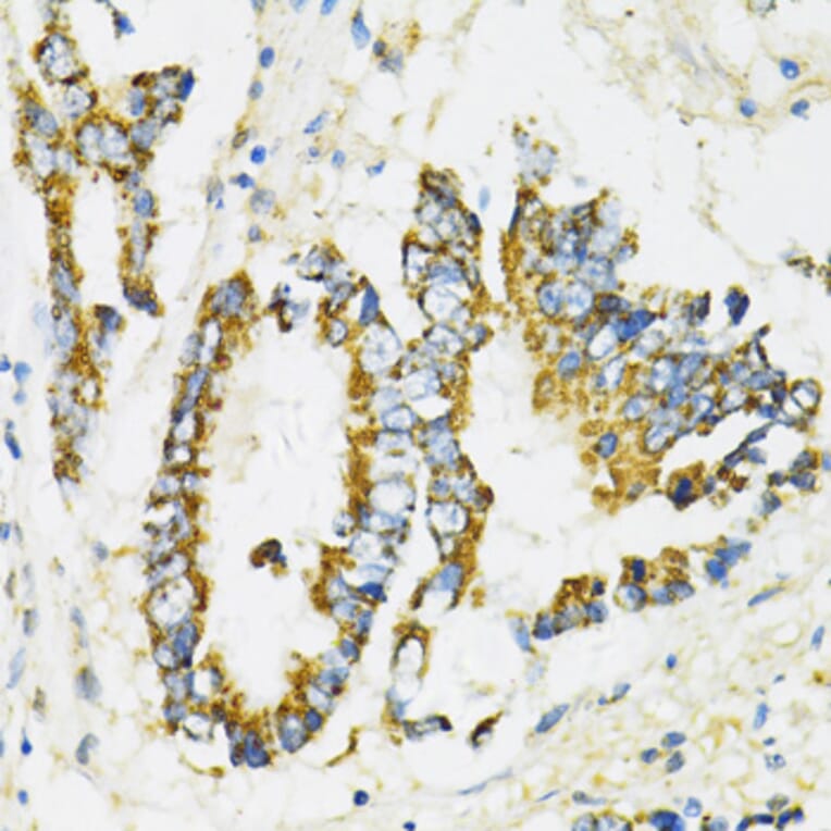 Immunohistochemistry - Anti-SERPINE1 Antibody (A14758) - Antibodies.com
