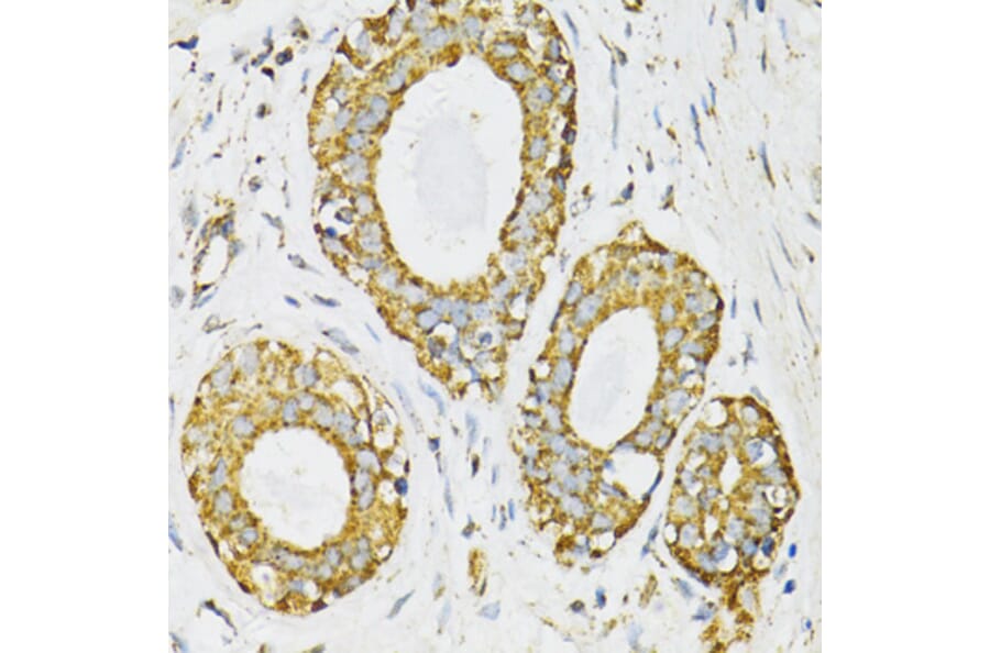 Immunohistochemistry - Anti-SERPINE1 Antibody (A14758) - Antibodies.com