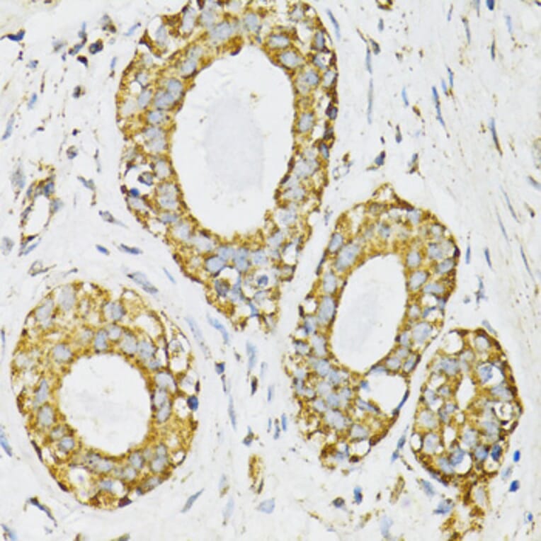 Immunohistochemistry - Anti-SERPINE1 Antibody (A14758) - Antibodies.com
