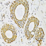 Immunohistochemistry - Anti-SERPINE1 Antibody (A14758) - Antibodies.com