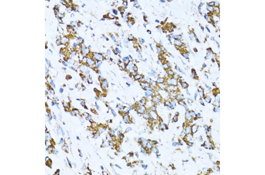 Immunohistochemistry - Anti-SERPINE1 Antibody (A14758) - Antibodies.com