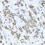 Immunohistochemistry - Anti-SERPINE1 Antibody (A14758) - Antibodies.com