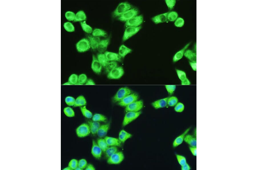 Immunofluorescence - Anti-SERPINE1 Antibody (A14758) - Antibodies.com