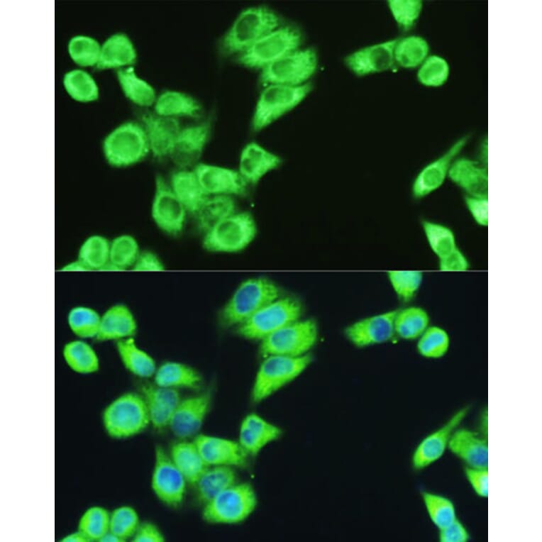 Immunofluorescence - Anti-SERPINE1 Antibody (A14758) - Antibodies.com