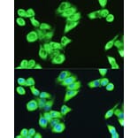 Immunofluorescence - Anti-SERPINE1 Antibody (A14758) - Antibodies.com