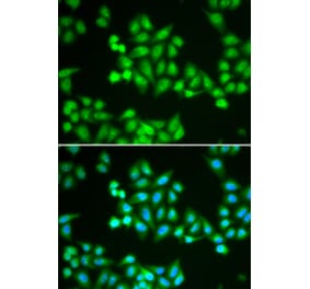 Immunofluorescence - Anti-CHD2 Antibody (A92288) - Antibodies.com