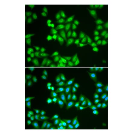 Immunofluorescence - Anti-CHD2 Antibody (A92288) - Antibodies.com