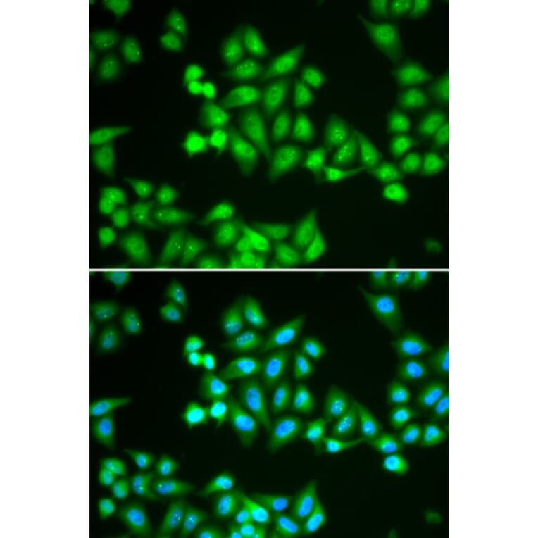 Immunofluorescence - Anti-CHD2 Antibody (A92288) - Antibodies.com