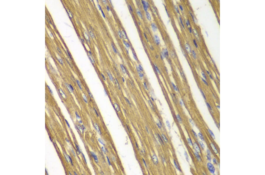 Immunohistochemistry - Anti-CASP7 Antibody (A0716) - Antibodies.com