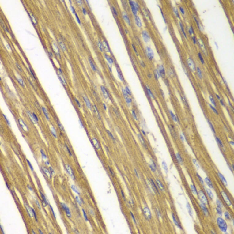 Immunohistochemistry - Anti-CASP7 Antibody (A0716) - Antibodies.com