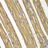 Immunohistochemistry - Anti-CASP7 Antibody (A0716) - Antibodies.com