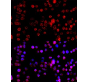 Immunofluorescence - Anti-CYP1B1 Antibody (A92291) - Antibodies.com
