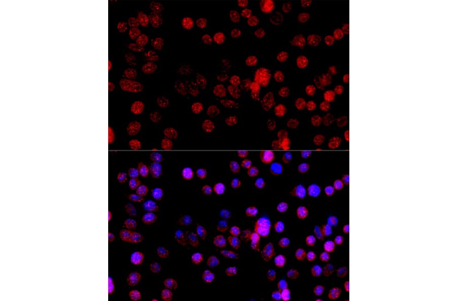 Immunofluorescence - Anti-CYP1B1 Antibody (A92291) - Antibodies.com