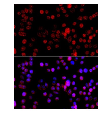 Immunofluorescence - Anti-CYP1B1 Antibody (A92291) - Antibodies.com