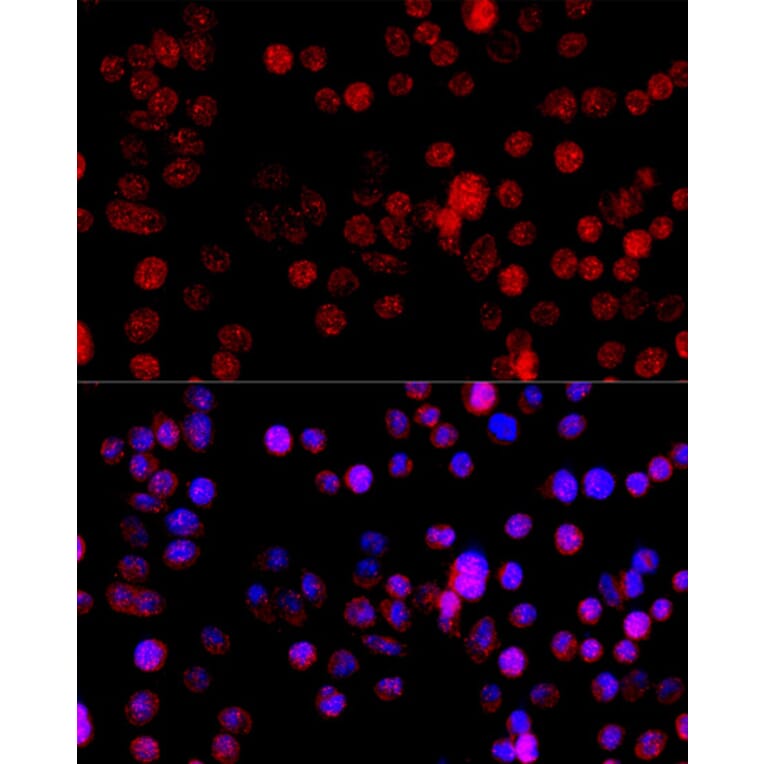 Immunofluorescence - Anti-CYP1B1 Antibody (A92291) - Antibodies.com