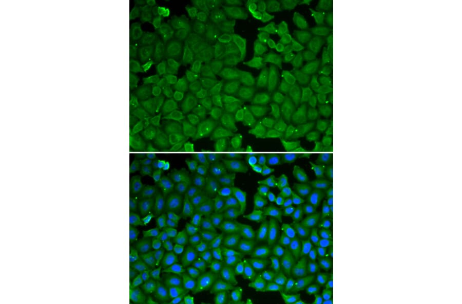 Immunofluorescence - Anti-SPINK1 Antibody (A92293) - Antibodies.com