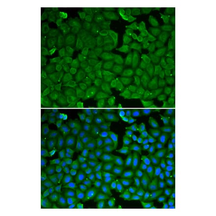 Immunofluorescence - Anti-SPINK1 Antibody (A92293) - Antibodies.com