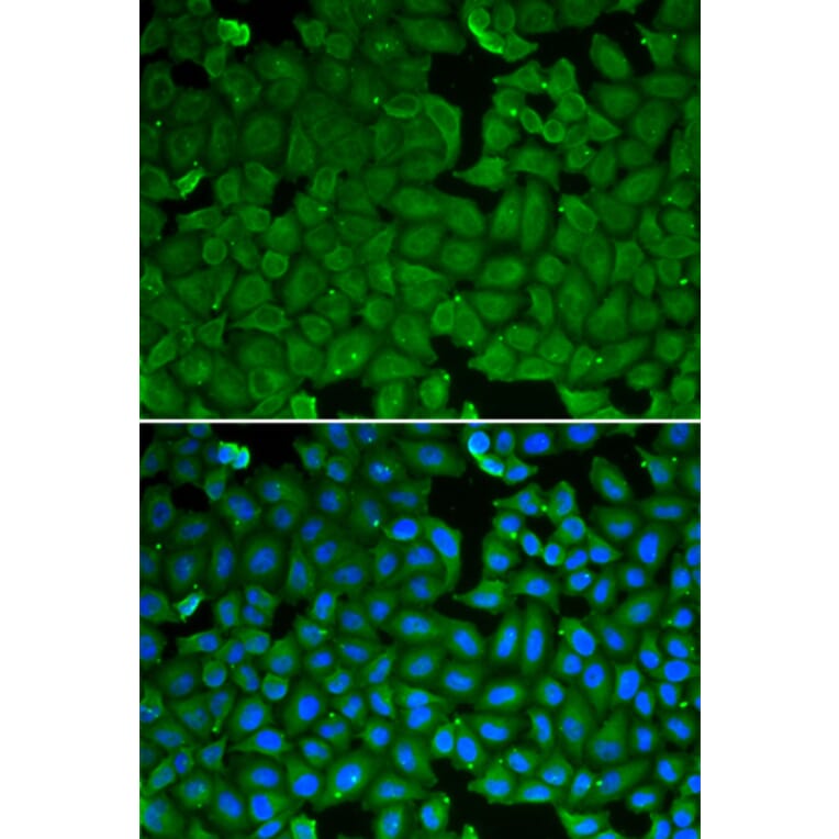 Immunofluorescence - Anti-SPINK1 Antibody (A92293) - Antibodies.com