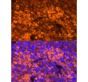 Immunofluorescence - Anti-RANTES Antibody (A92294) - Antibodies.com