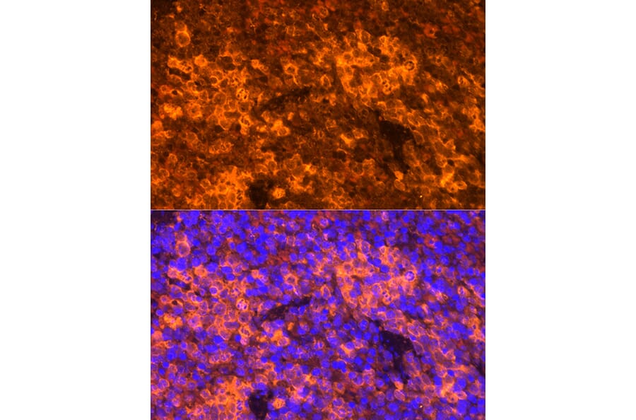 Immunofluorescence - Anti-RANTES Antibody (A92294) - Antibodies.com