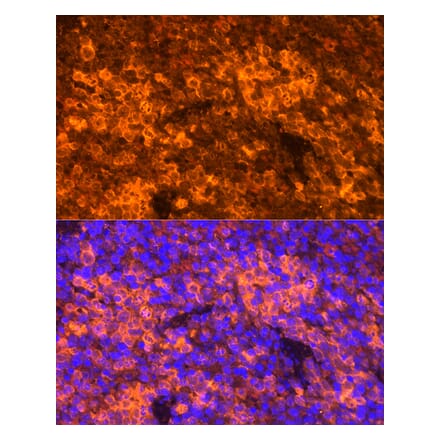 Immunofluorescence - Anti-RANTES Antibody (A92294) - Antibodies.com