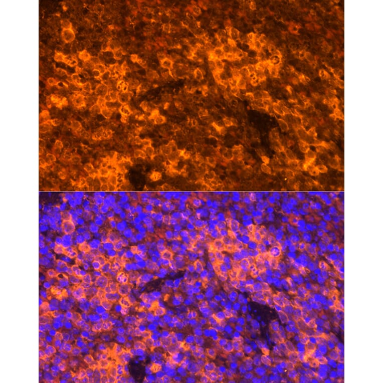 Immunofluorescence - Anti-RANTES Antibody (A92294) - Antibodies.com